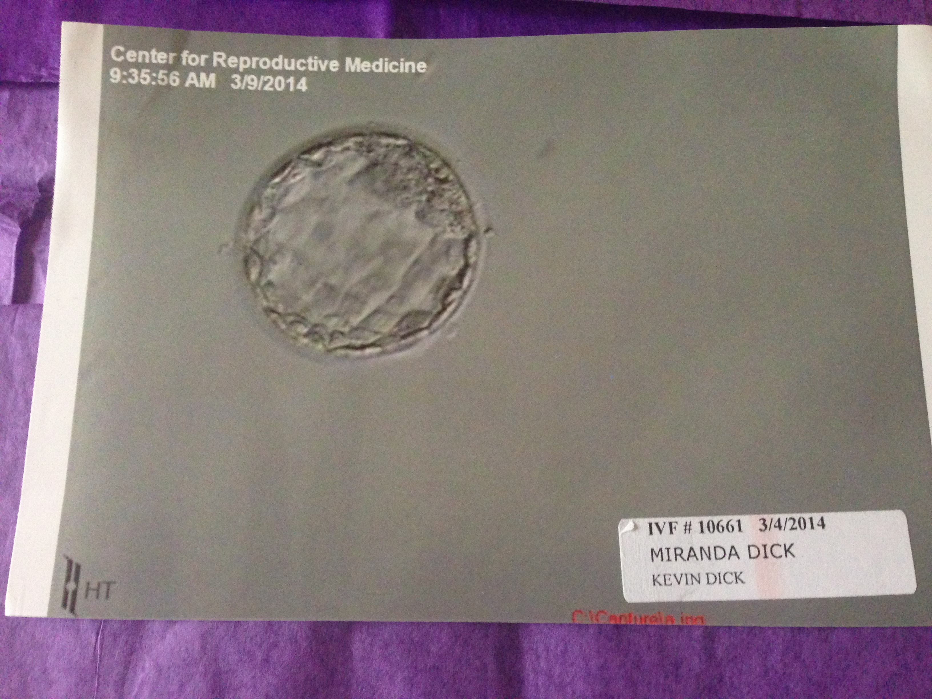 Baby Gavin as an embryo 