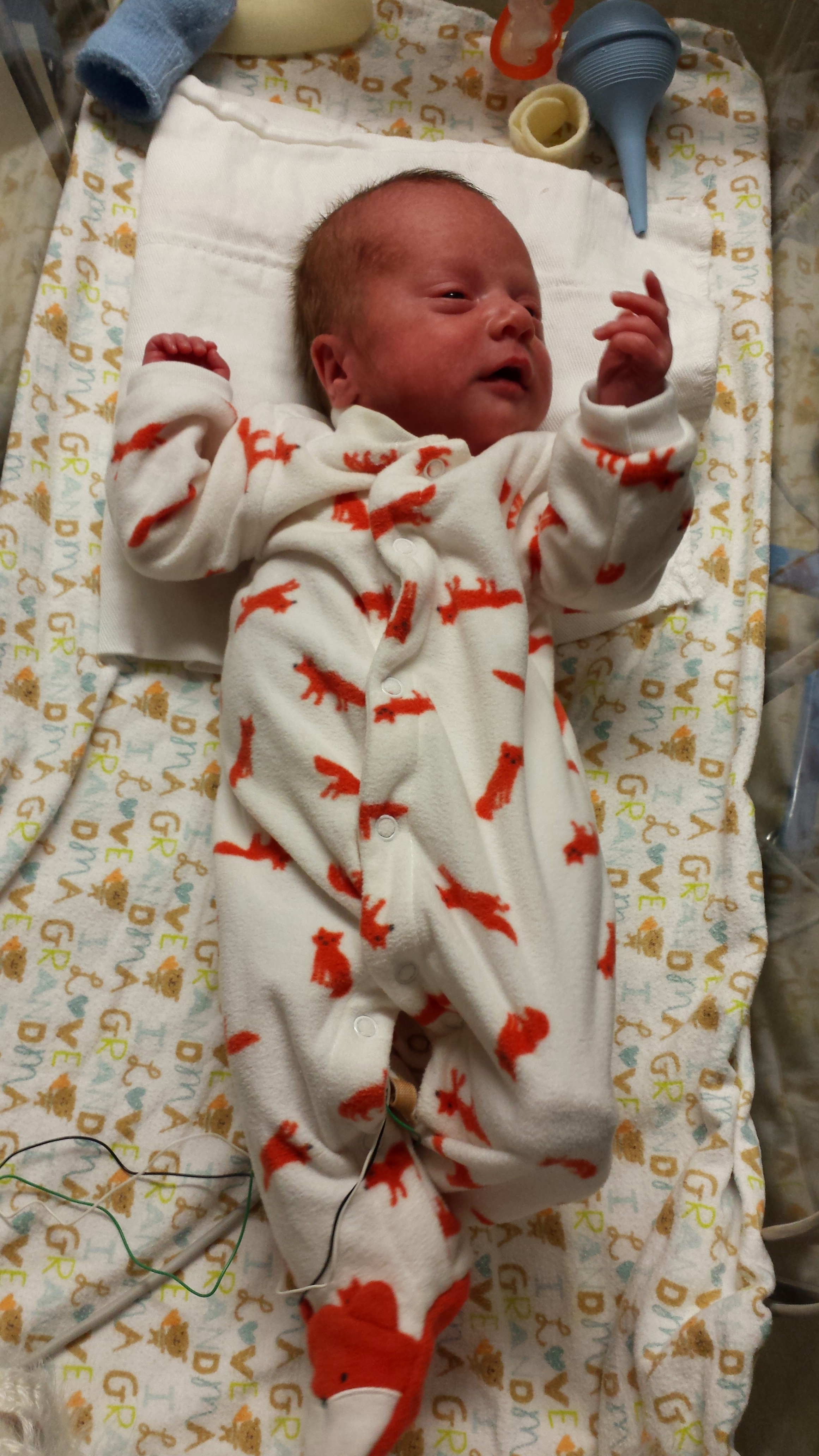 Feeding tube came out!!