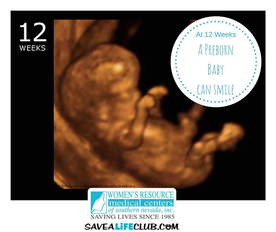 12 Weeks in the Womb!