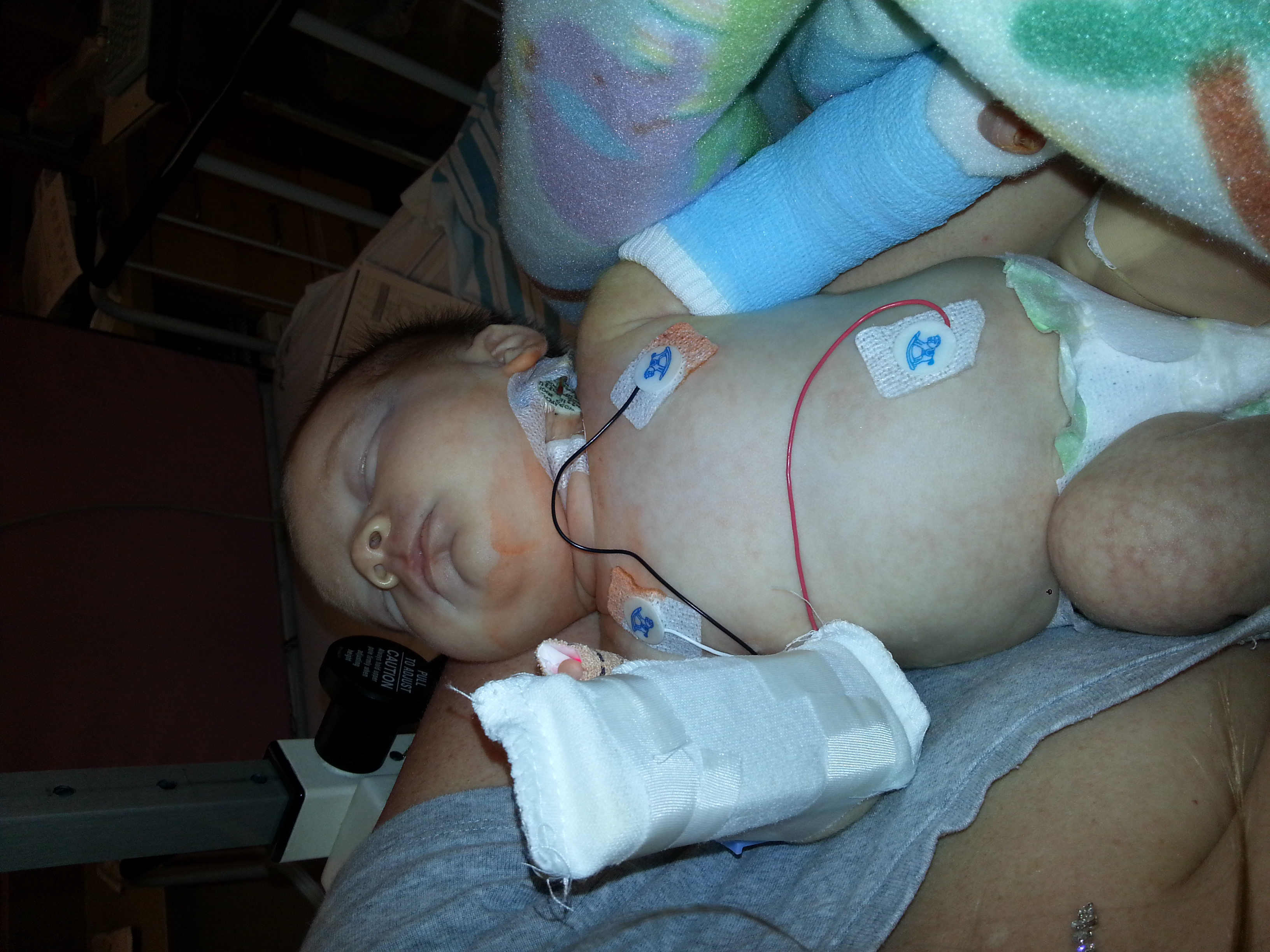 Connor: Post Surgery #1