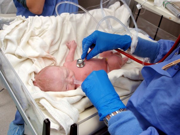 The moment her special heart was discovered.