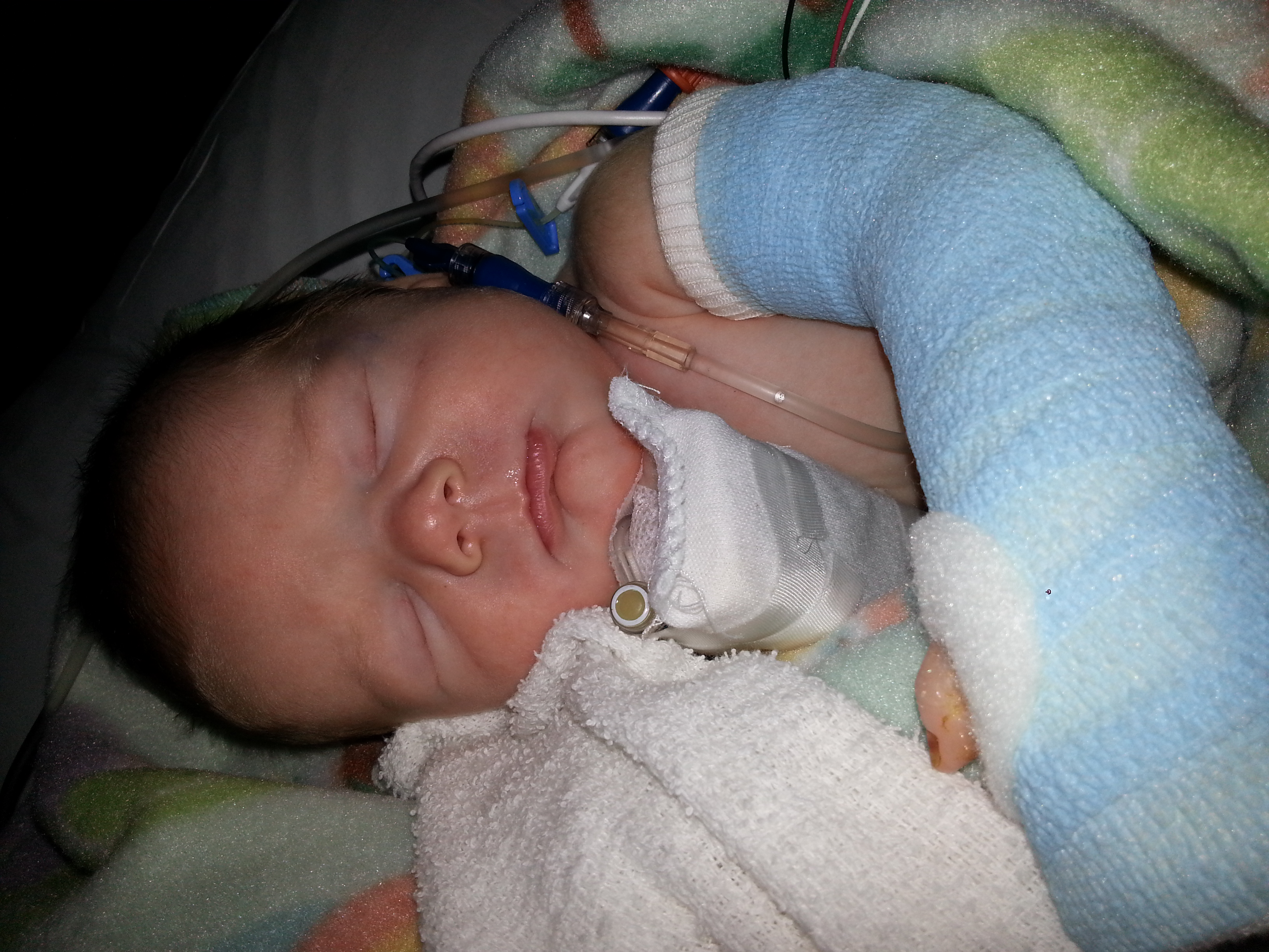 Connor: Post Surgery Snuggles