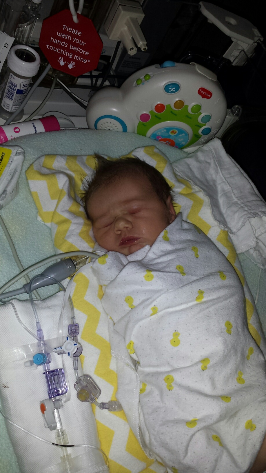 Claire in the NICU before moving to the CVCC