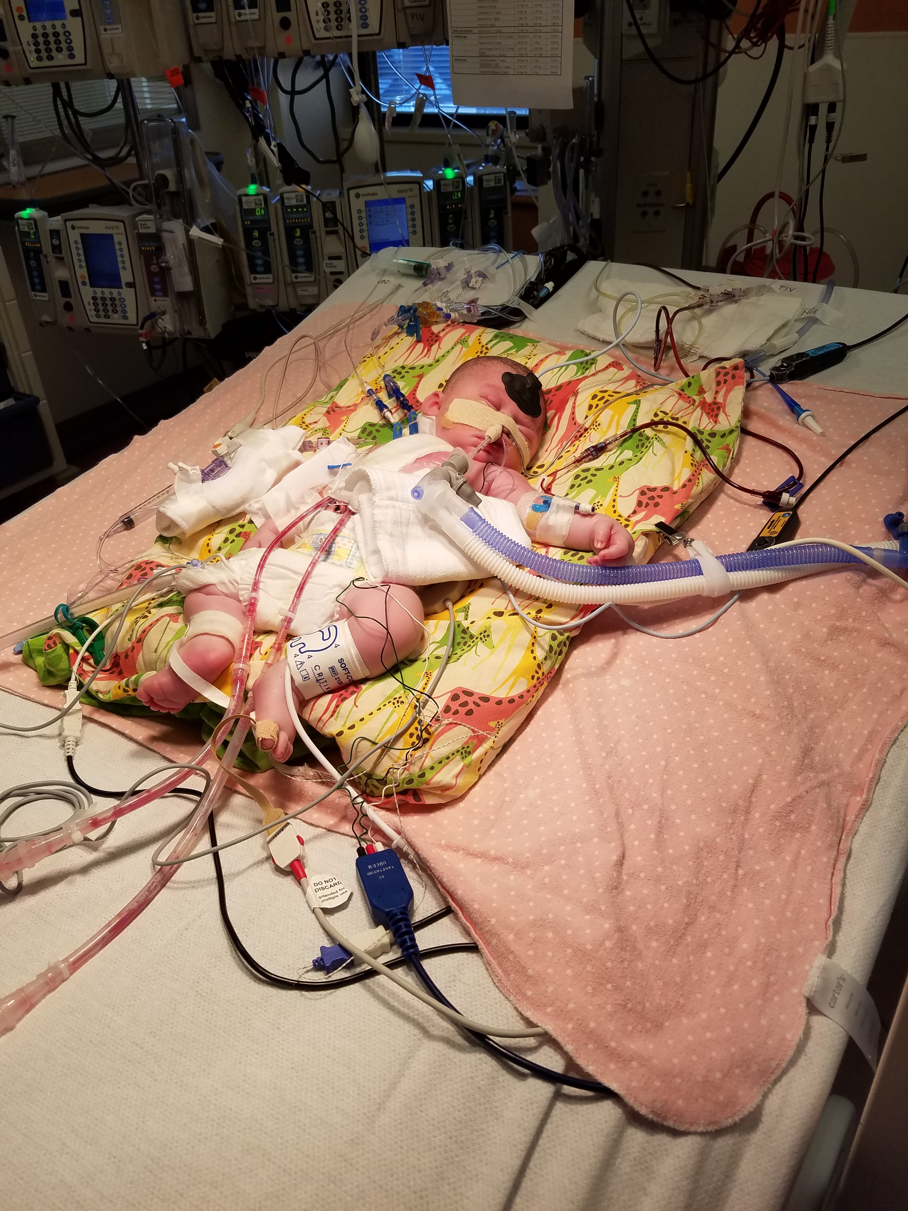 Post Open Heart Surgery