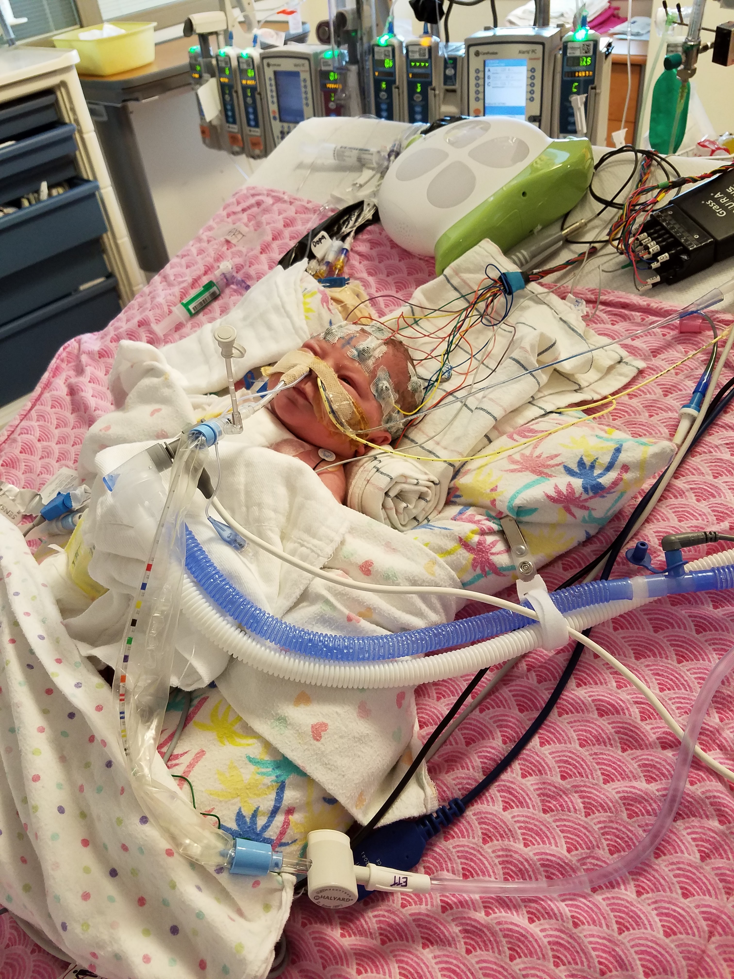 A few weeks old at Minneapolis Children's Hospital