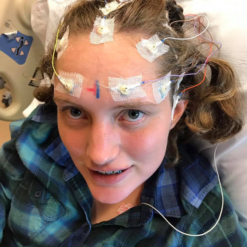 Annual Overnight EEG