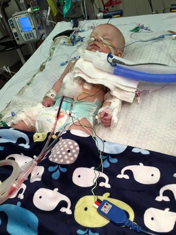 Little Leo love - immediately after his open heart surgery