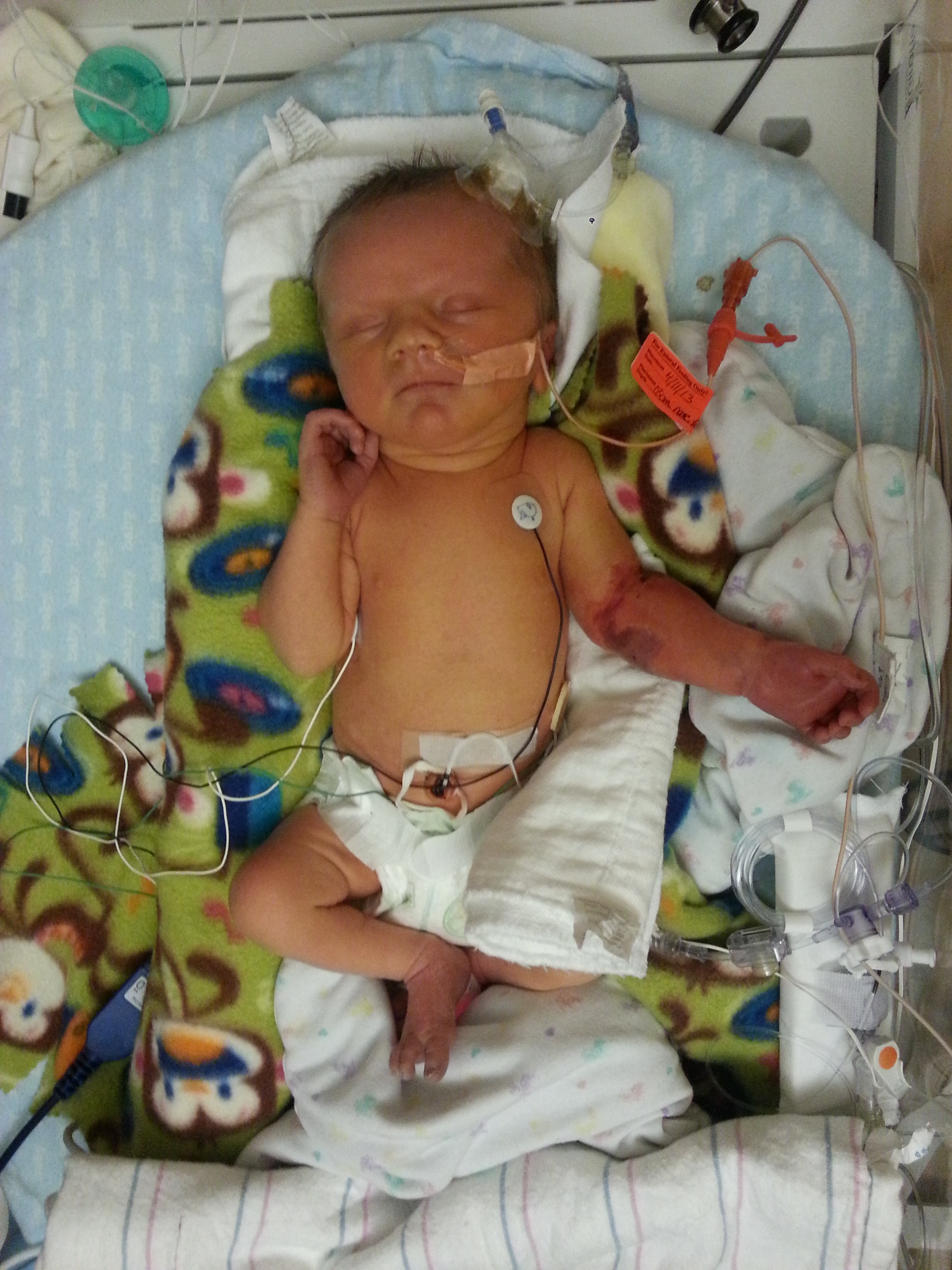 Connor in the NICU