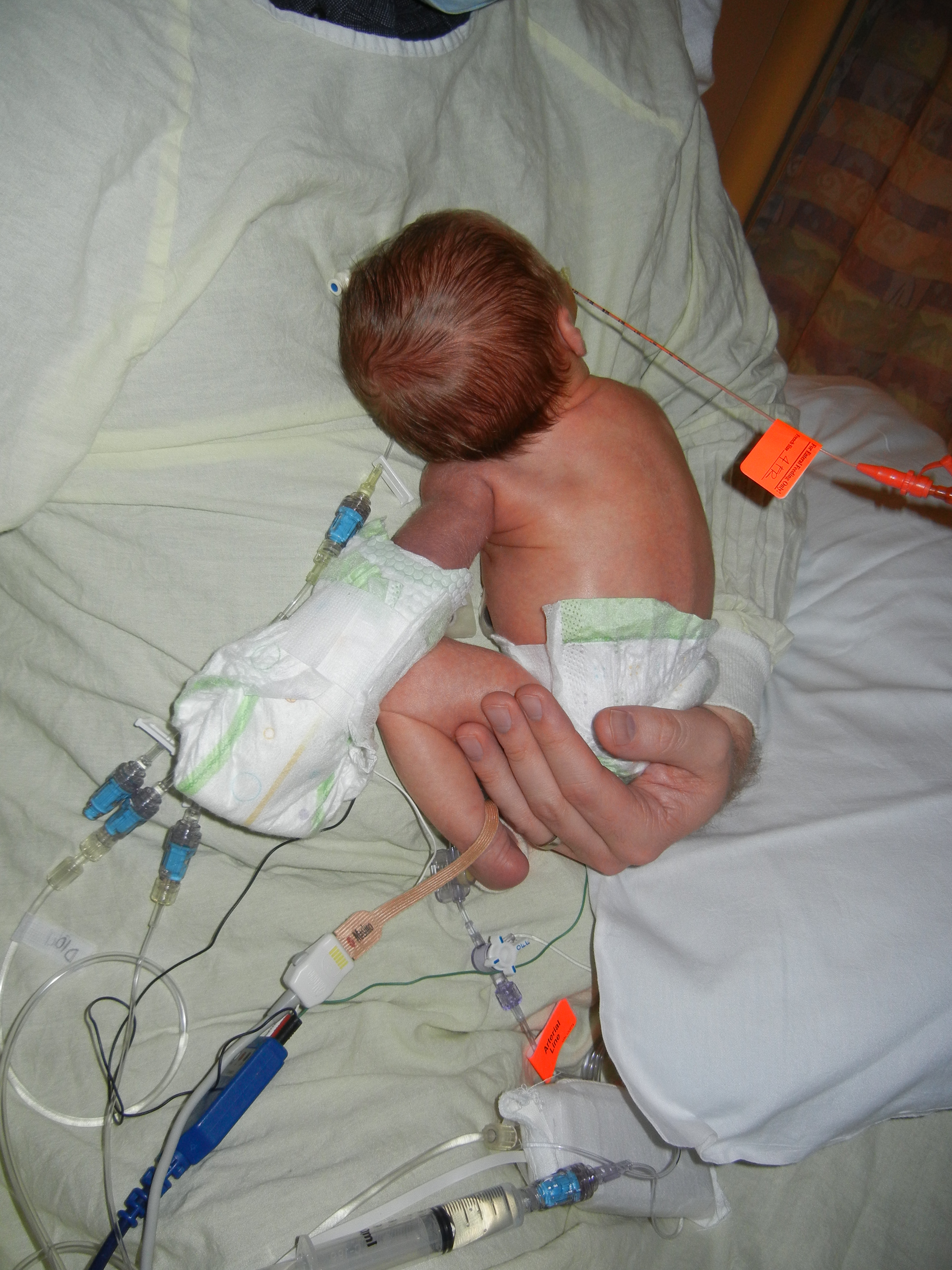 Connor in the NICU