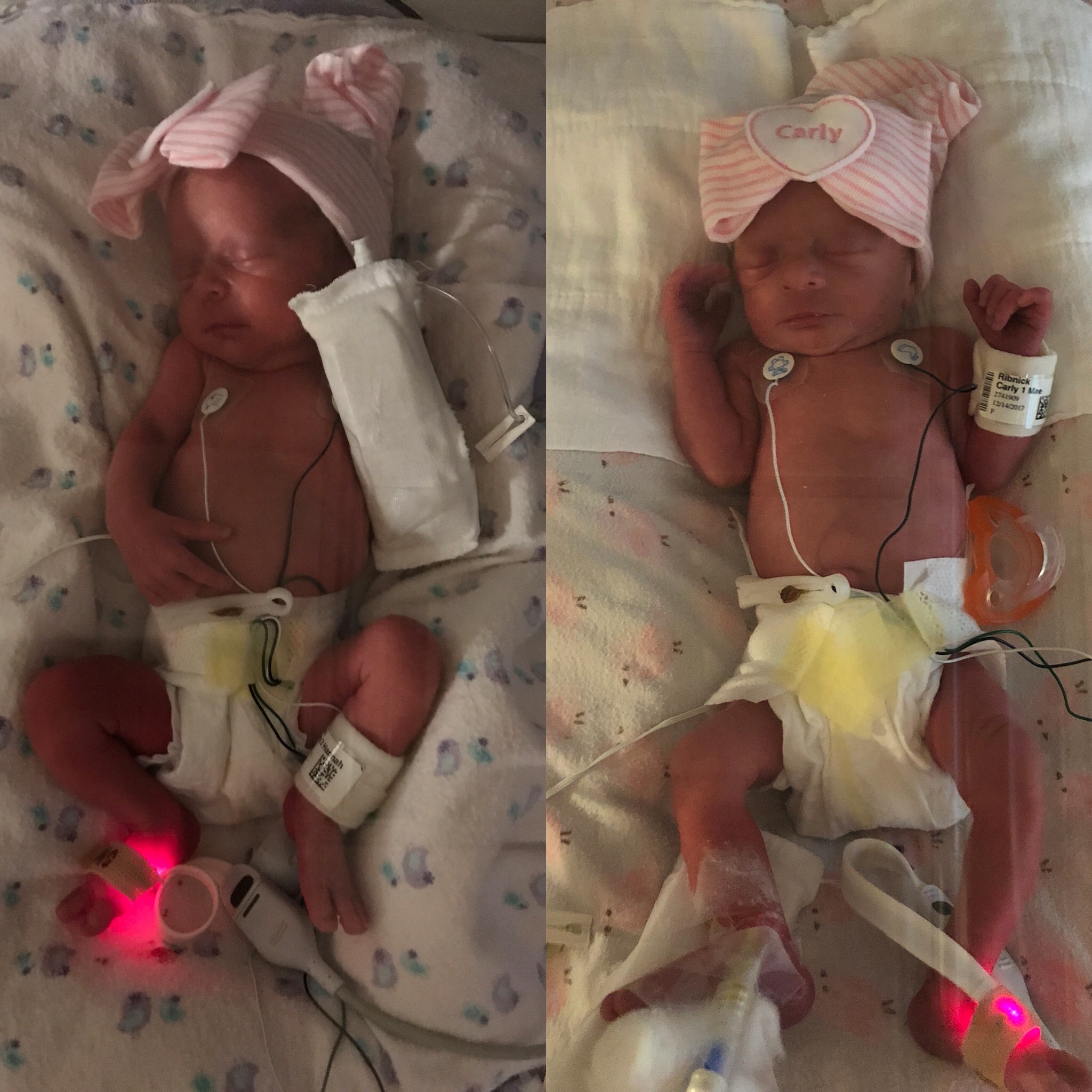 Sydney and Carly  right after they were born... small but mighty