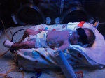 Max under the bili-lights just days old
