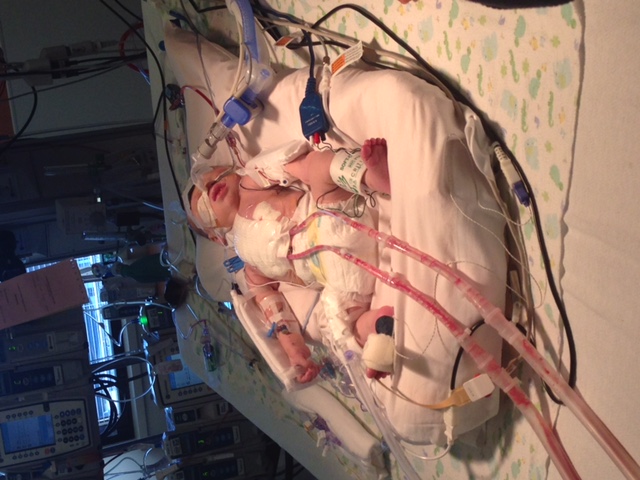 Luca after first surgery at 3 days old