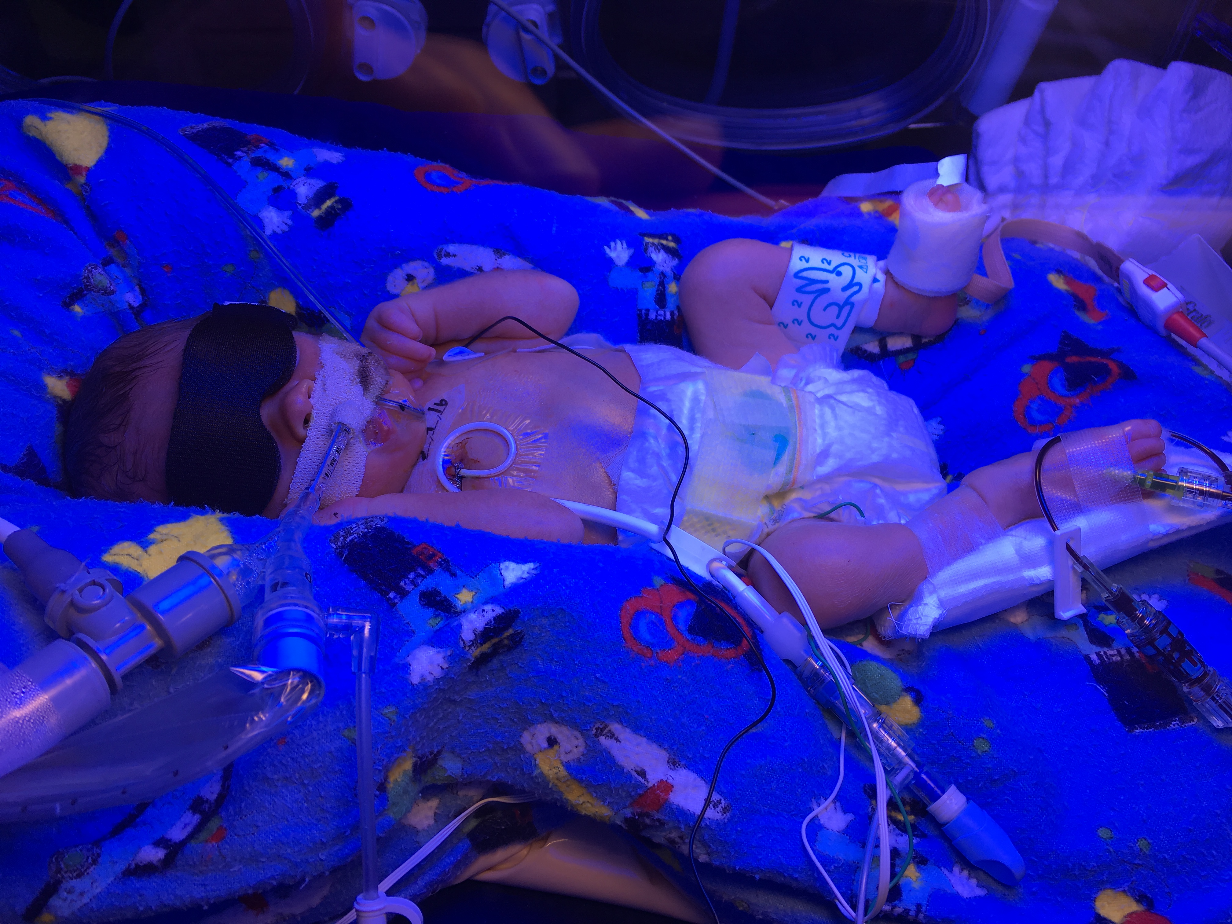 February 2016 - 6 Days Old