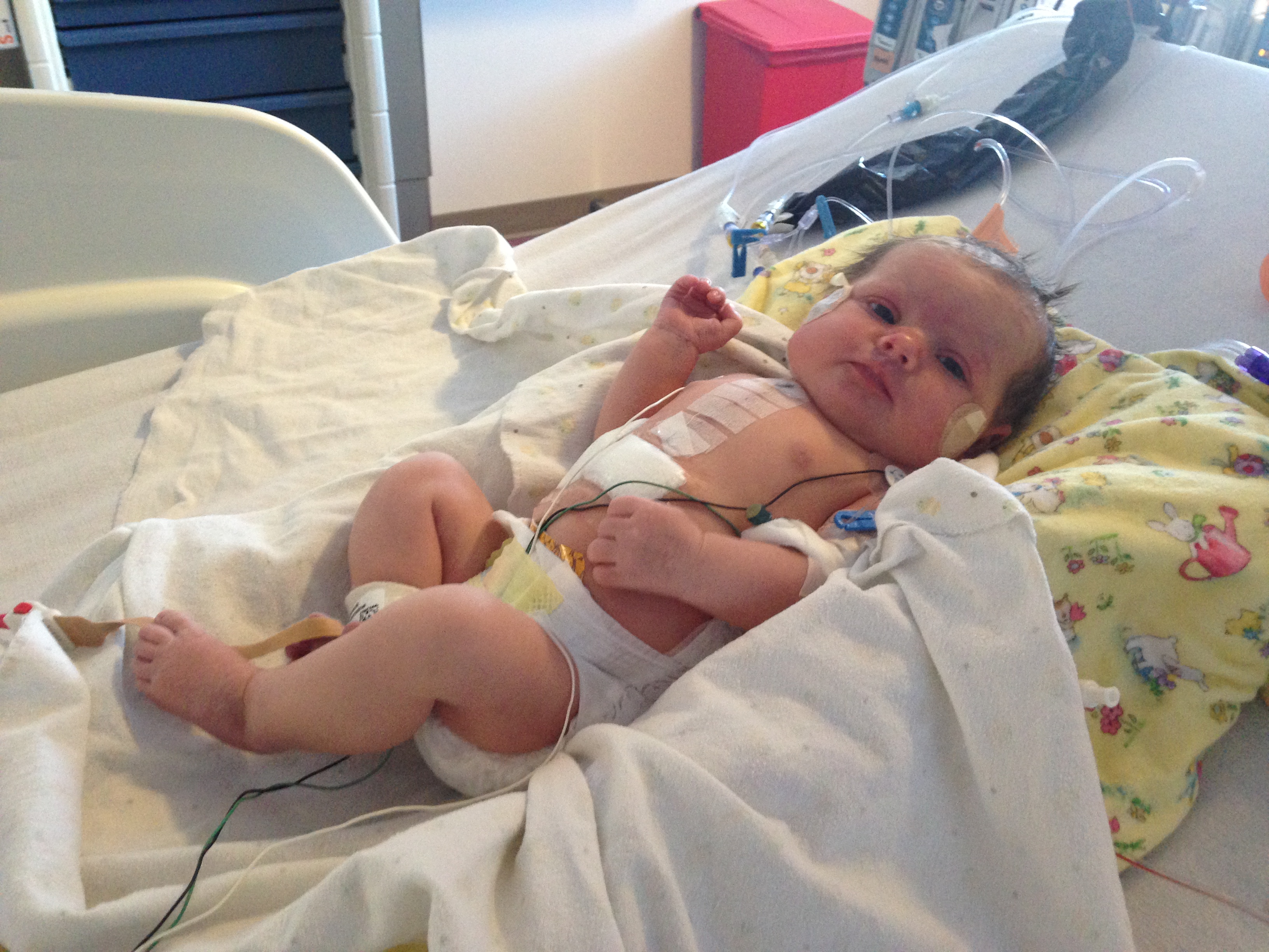 Post open heart surgery.