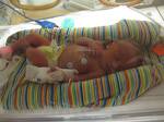 1st picture in NICU