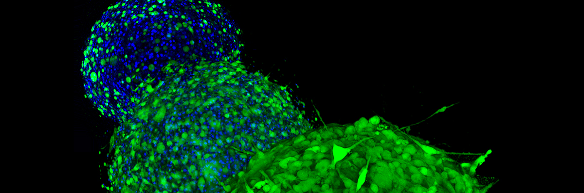 Team Elbo & Team Patio 2019 Melanoma Walk 