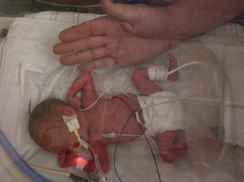 March 19, 2010.... born SOOO tiny...  2# 6.5 oz