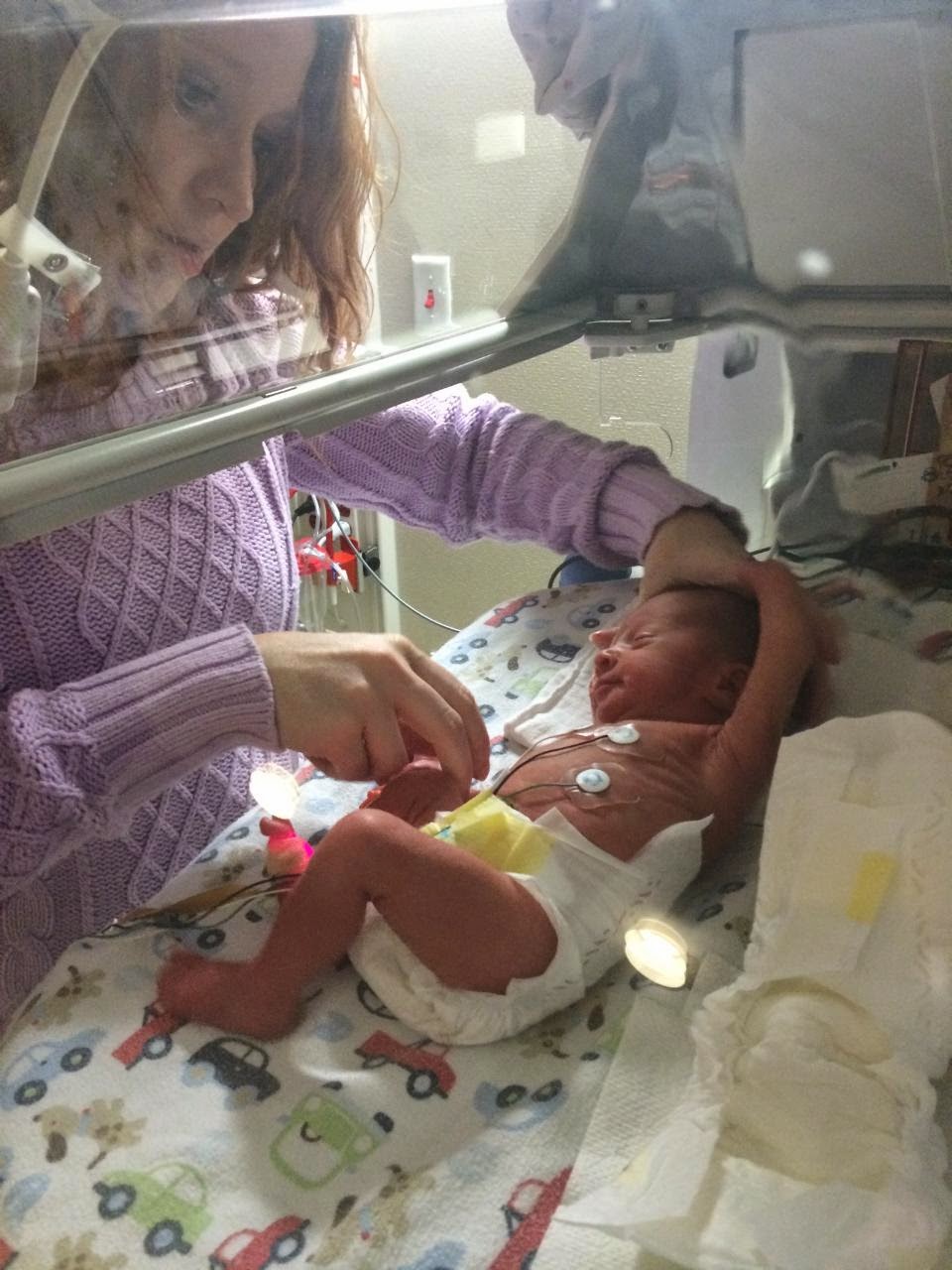 NICU diaper changes in the isolette weren't easy!