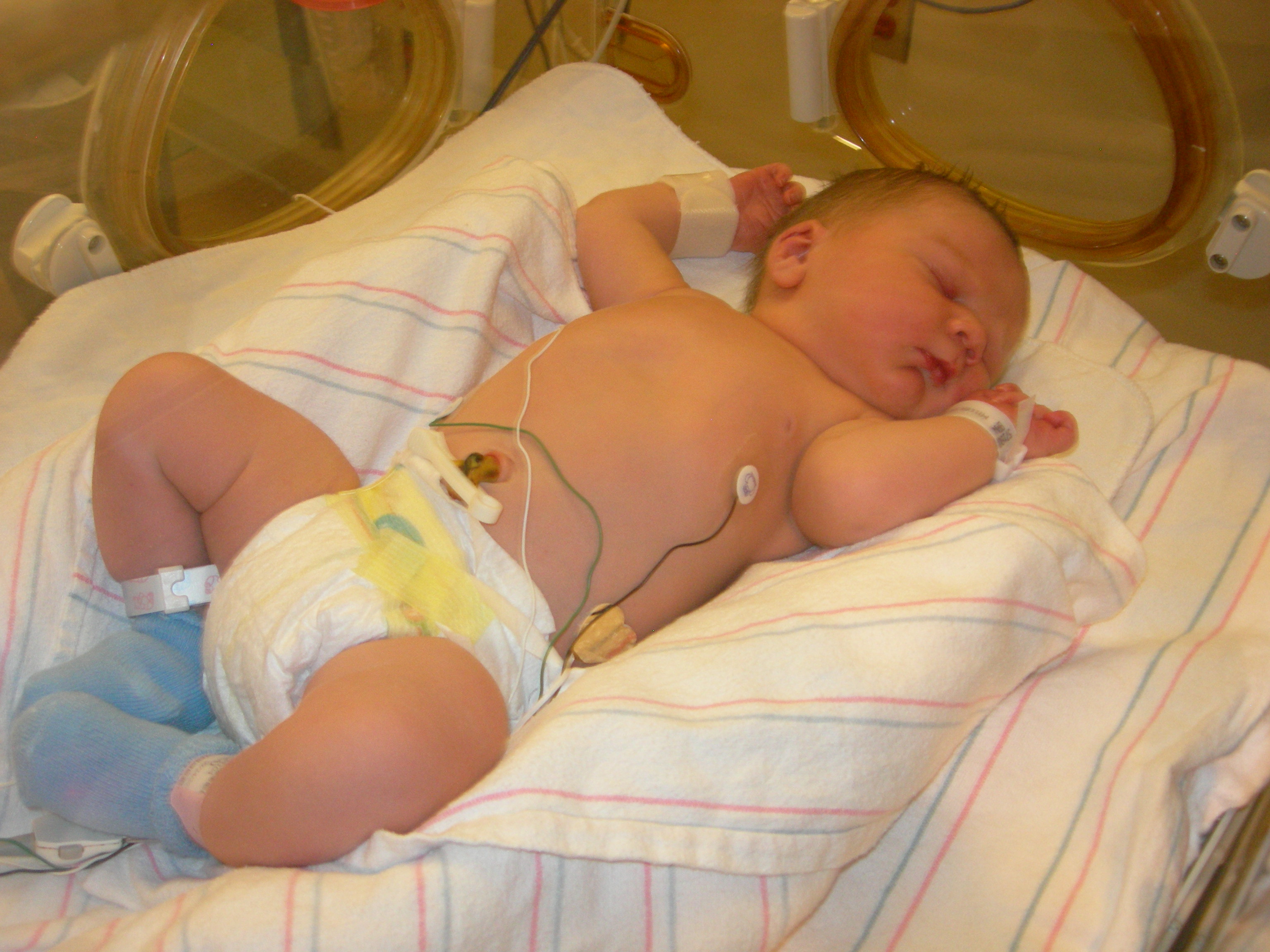 Parker in the NICU