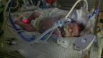 Tyler in Children's NICU